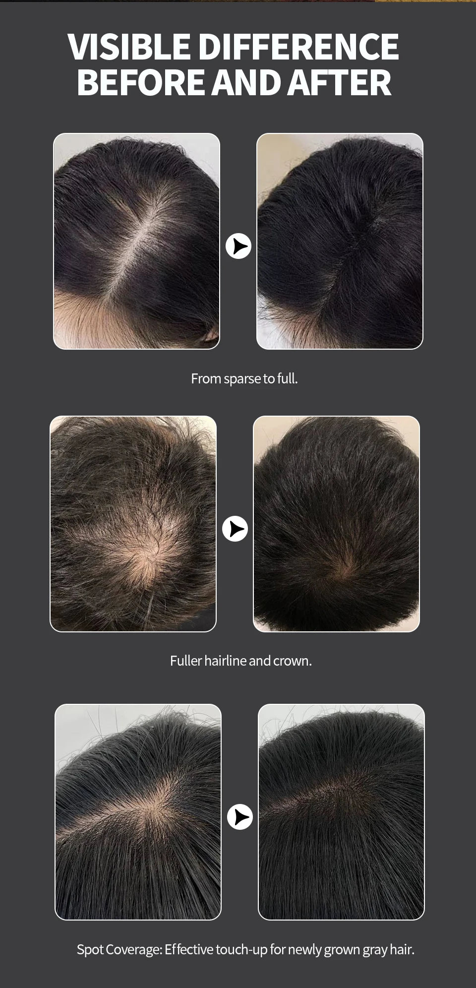 Hair Fibers Powder Instant Hair Growth Fiber Keratin Thickening Spray Applicator Hair Building Fibers Hair Loss Regrowth Powder