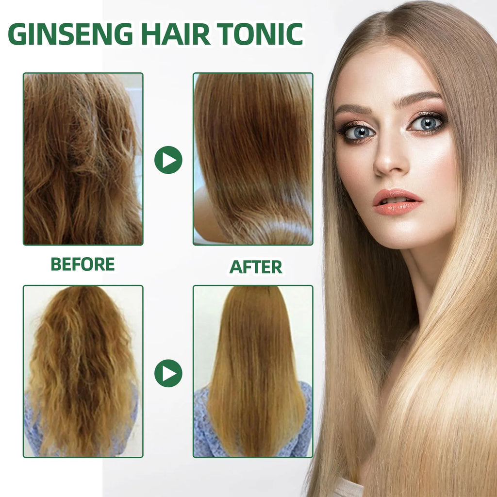 Ouhoe Ginseng Hair Growth Serum 100ml Nourish Scalp Bioactive Formula Promote Hair Regrowth Reduce Hair Fall Strengthen Roots