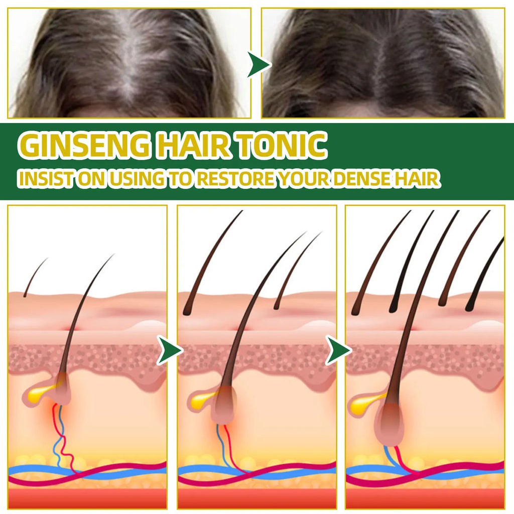Ouhoe Ginseng Hair Growth Serum 100ml Nourish Scalp Bioactive Formula Promote Hair Regrowth Reduce Hair Fall Strengthen Roots