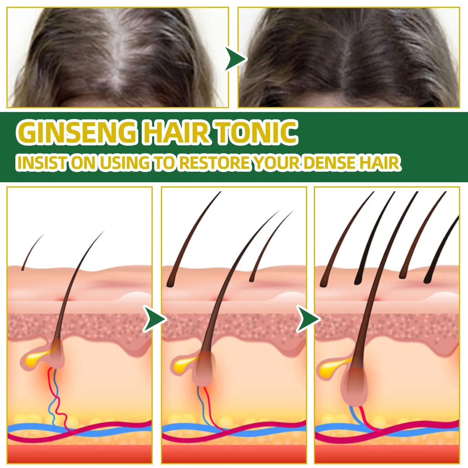 Ouhoe Ginseng Hair Growth Serum 100ml Nourish Scalp Bioactive Formula Promote Hair Regrowth Reduce Hair Fall Strengthen Roots