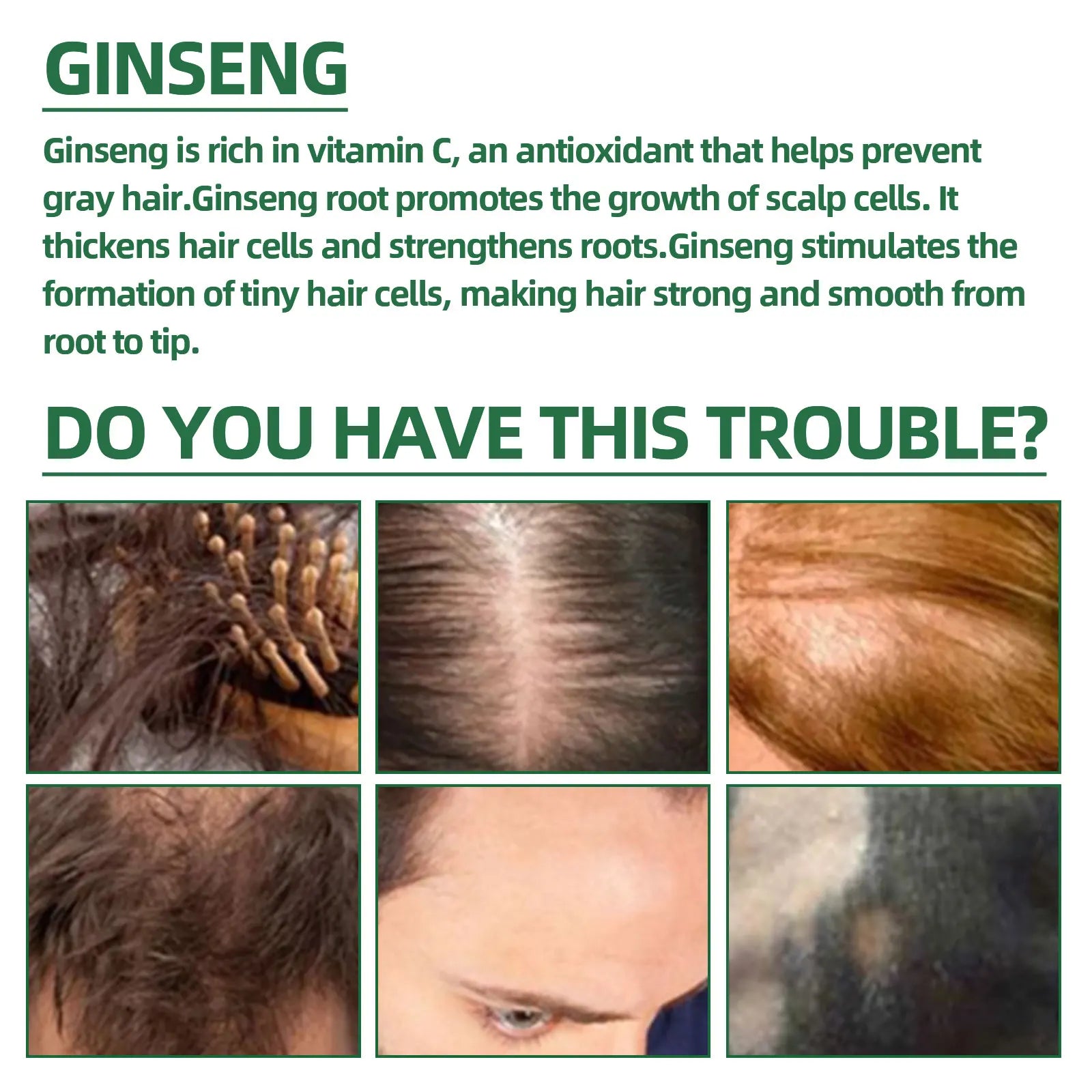 Ouhoe Ginseng Hair Growth Serum 100ml Nourish Scalp Bioactive Formula Promote Hair Regrowth Reduce Hair Fall Strengthen Roots