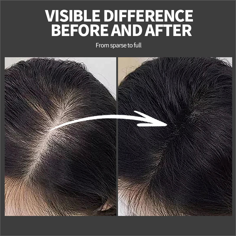 Hair Fibers Powder Instant Hair Growth Fiber Keratin Thickening Spray Applicator Hair Building Fibers Hair Loss Regrowth Powder